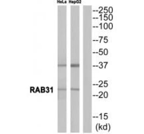 Western blot - RAB31 Antibody from Signalway Antibody (34968) - Antibodies.com