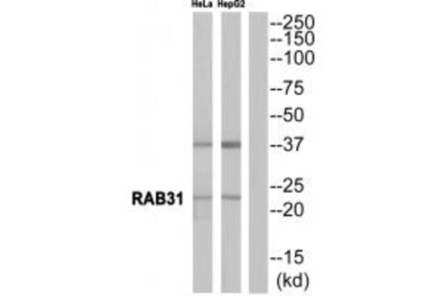 Western blot - RAB31 Antibody from Signalway Antibody (34968) - Antibodies.com