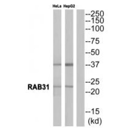 Western blot - RAB31 Antibody from Signalway Antibody (34968) - Antibodies.com