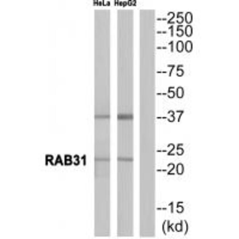 Western blot - RAB31 Antibody from Signalway Antibody (34968) - Antibodies.com