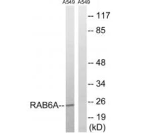 Western blot - RAB6A Antibody from Signalway Antibody (34972) - Antibodies.com