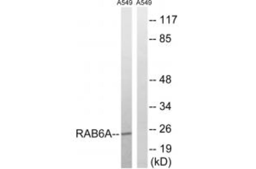 Western blot - RAB6A Antibody from Signalway Antibody (34972) - Antibodies.com