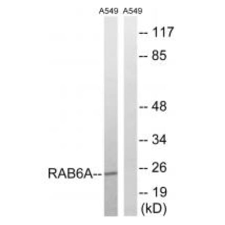 Western blot - RAB6A Antibody from Signalway Antibody (34972) - Antibodies.com