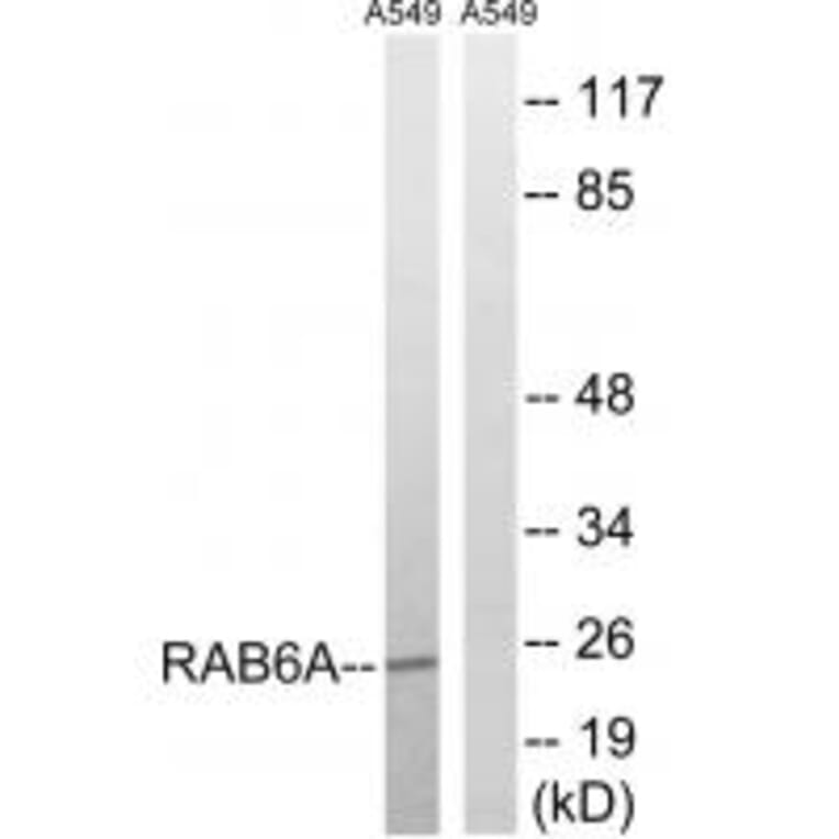 Western blot - RAB6A Antibody from Signalway Antibody (34972) - Antibodies.com