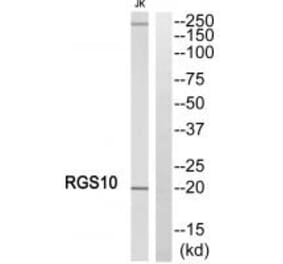 Western blot - RGS10 Antibody from Signalway Antibody (34980) - Antibodies.com