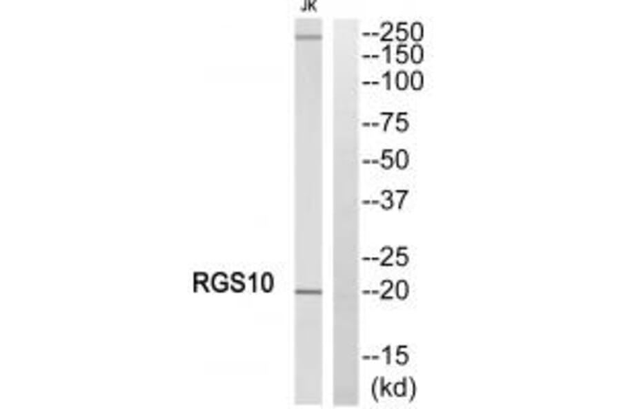 Western blot - RGS10 Antibody from Signalway Antibody (34980) - Antibodies.com