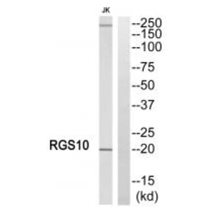 Western blot - RGS10 Antibody from Signalway Antibody (34980) - Antibodies.com