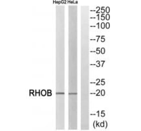 Western blot - RHOB Antibody from Signalway Antibody (34999) - Antibodies.com
