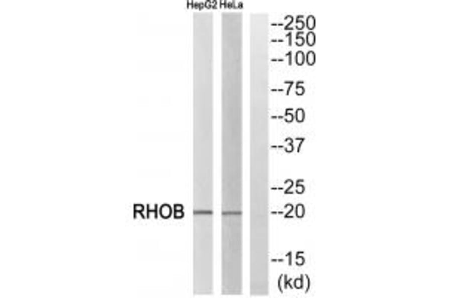 Western blot - RHOB Antibody from Signalway Antibody (34999) - Antibodies.com