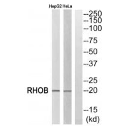 Western blot - RHOB Antibody from Signalway Antibody (34999) - Antibodies.com