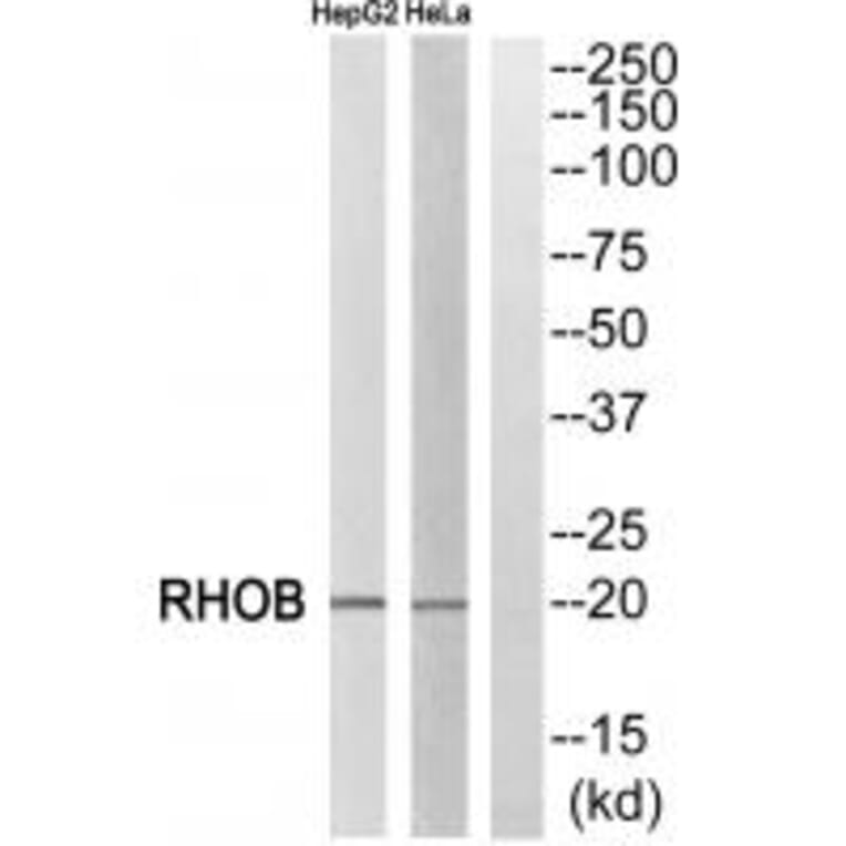 Western blot - RHOB Antibody from Signalway Antibody (34999) - Antibodies.com