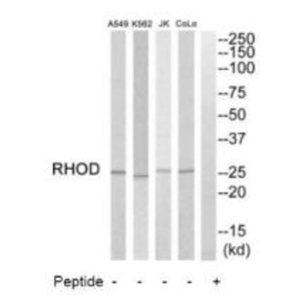 Western blot - RHOD Antibody from Signalway Antibody (35000) - Antibodies.com