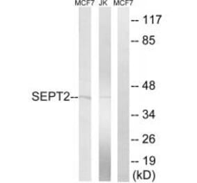 Western blot - SEPT2 Antibody from Signalway Antibody (35014) - Antibodies.com