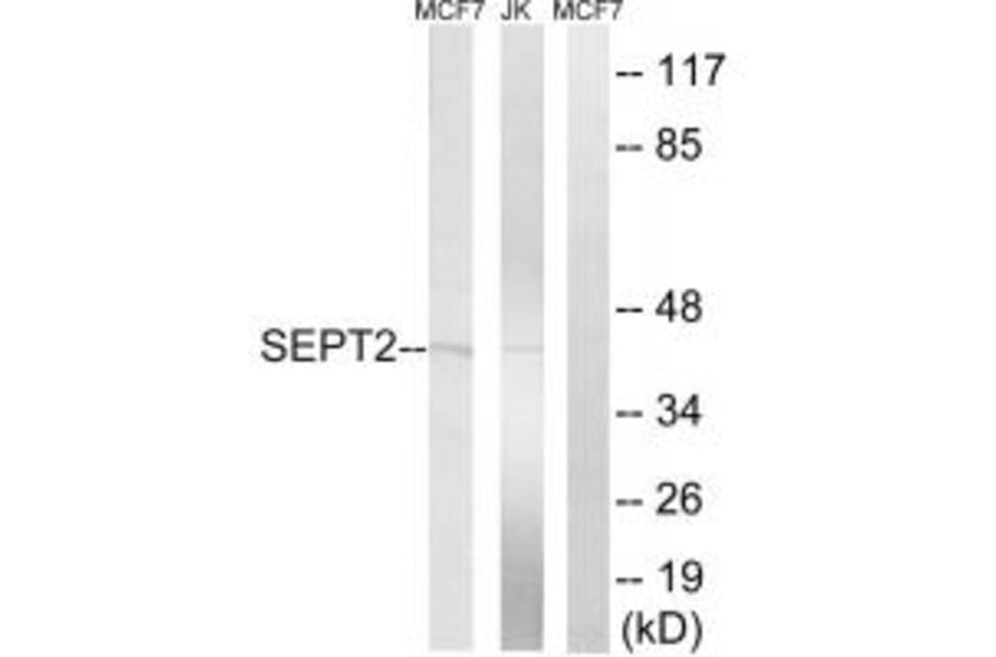Western blot - SEPT2 Antibody from Signalway Antibody (35014) - Antibodies.com
