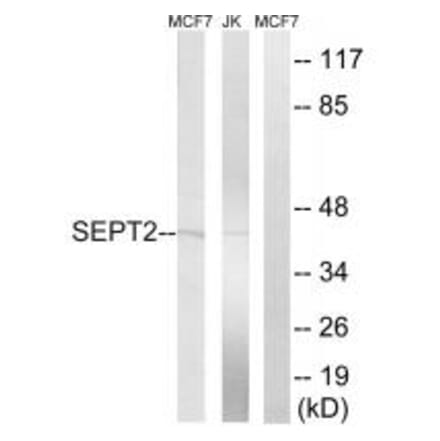 Western blot - SEPT2 Antibody from Signalway Antibody (35014) - Antibodies.com