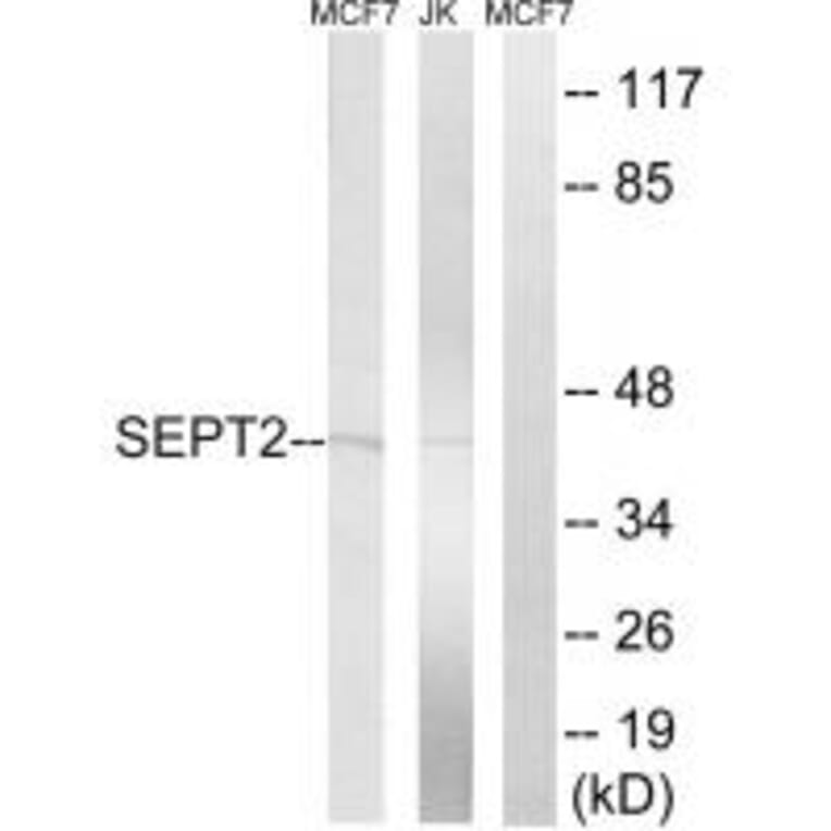 Western blot - SEPT2 Antibody from Signalway Antibody (35014) - Antibodies.com