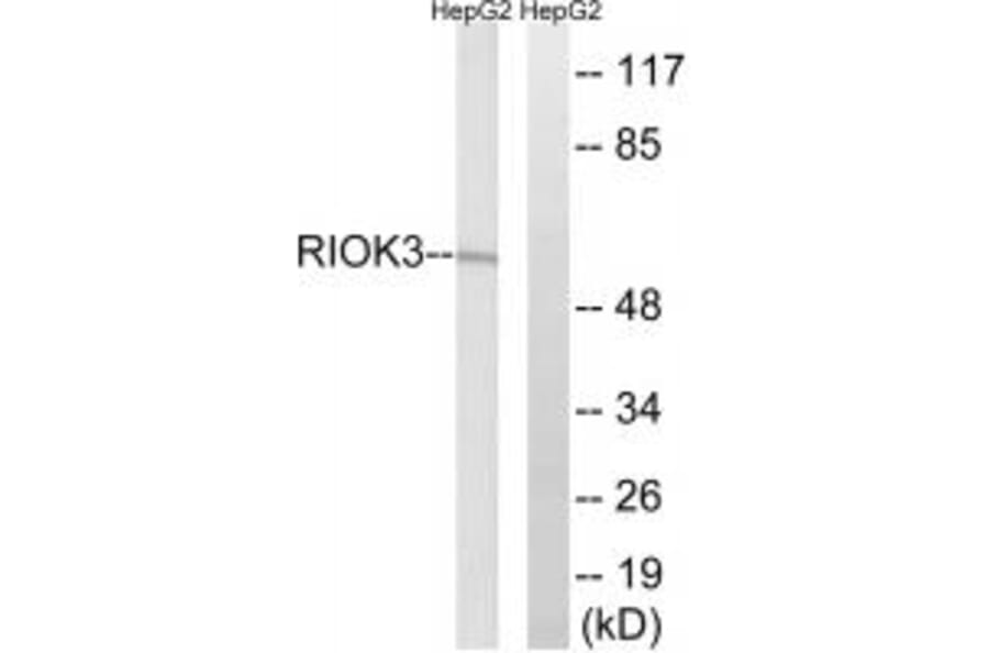 Western blot - RIOK3 Antibody from Signalway Antibody (35027) - Antibodies.com