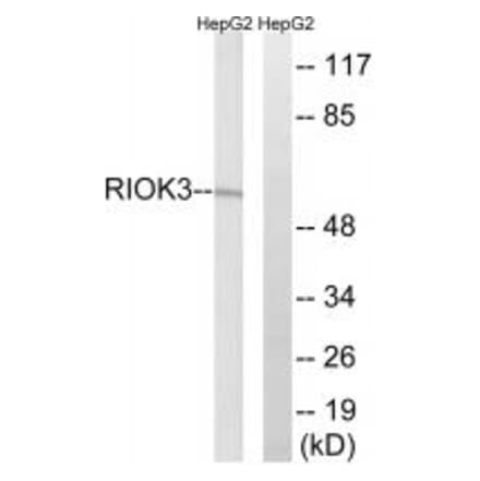 Western blot - RIOK3 Antibody from Signalway Antibody (35027) - Antibodies.com