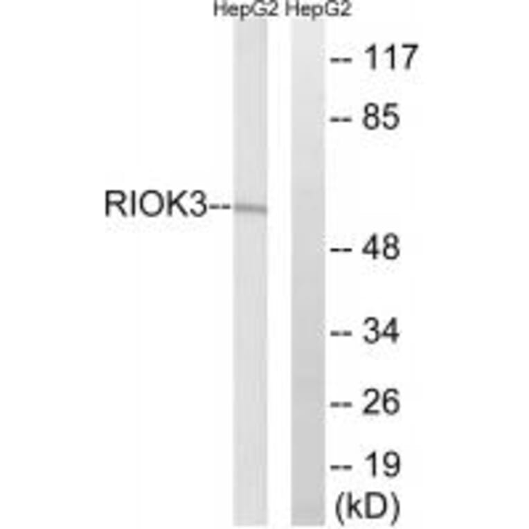 Western blot - RIOK3 Antibody from Signalway Antibody (35027) - Antibodies.com