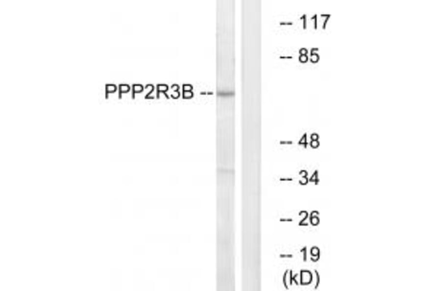 Western blot - P2R3B Antibody from Signalway Antibody (35032) - Antibodies.com