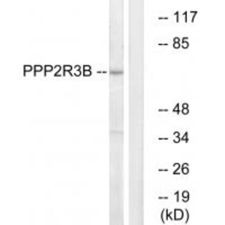 Western blot - P2R3B Antibody from Signalway Antibody (35032) - Antibodies.com