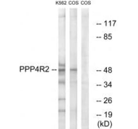 Western blot - PP4R2 Antibody from Signalway Antibody (35035) - Antibodies.com