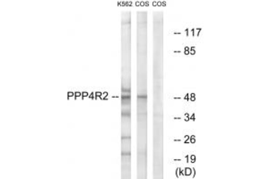 Western blot - PP4R2 Antibody from Signalway Antibody (35035) - Antibodies.com