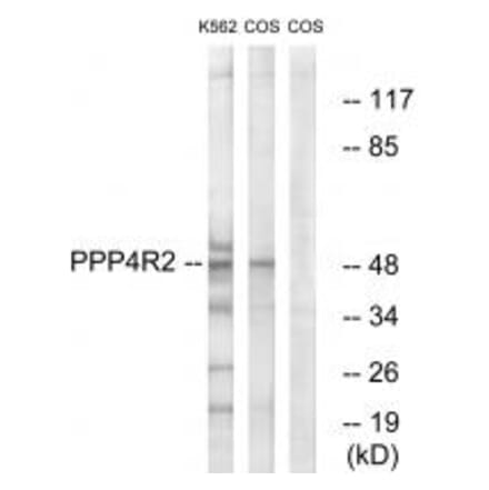 Western blot - PP4R2 Antibody from Signalway Antibody (35035) - Antibodies.com