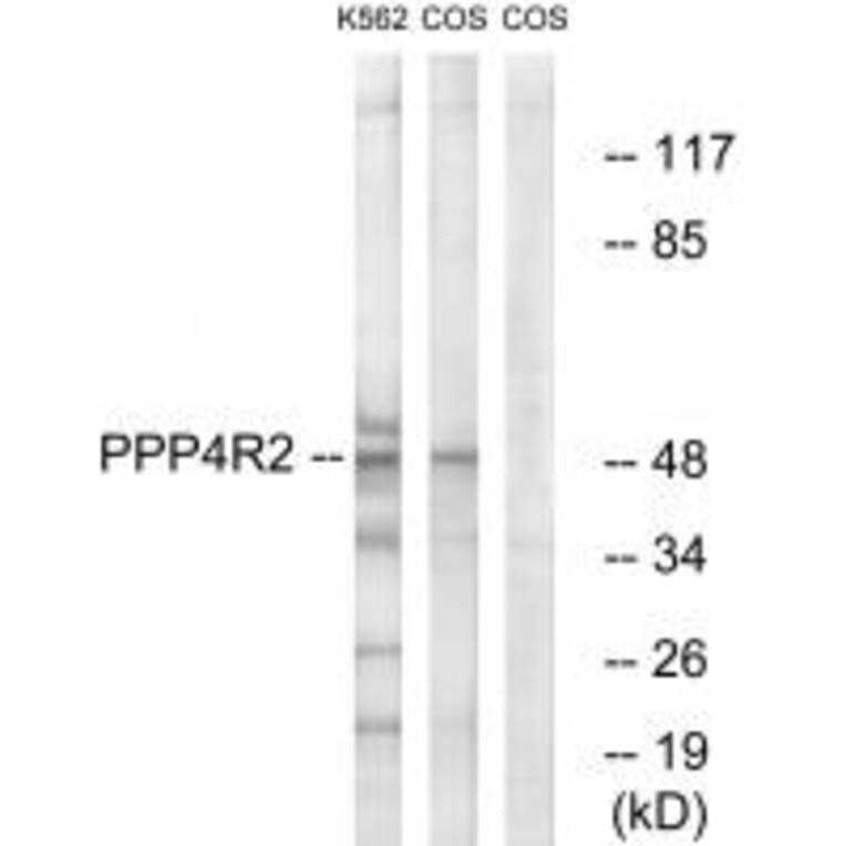 Western blot - PP4R2 Antibody from Signalway Antibody (35035) - Antibodies.com