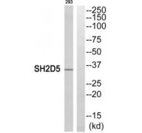 Western blot - SH2D5 Antibody from Signalway Antibody (35042) - Antibodies.com