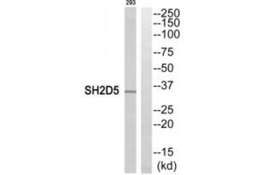 Western blot - SH2D5 Antibody from Signalway Antibody (35042) - Antibodies.com