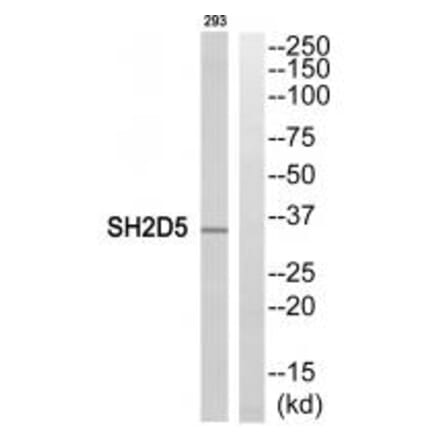 Western blot - SH2D5 Antibody from Signalway Antibody (35042) - Antibodies.com