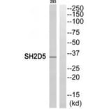 Western blot - SH2D5 Antibody from Signalway Antibody (35042) - Antibodies.com