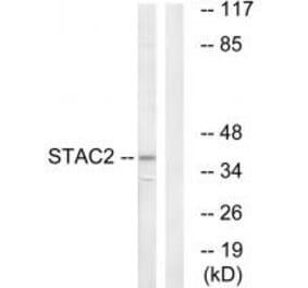 Western blot - STAC2 Antibody from Signalway Antibody (35043) - Antibodies.com