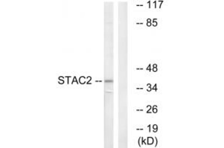 Western blot - STAC2 Antibody from Signalway Antibody (35043) - Antibodies.com