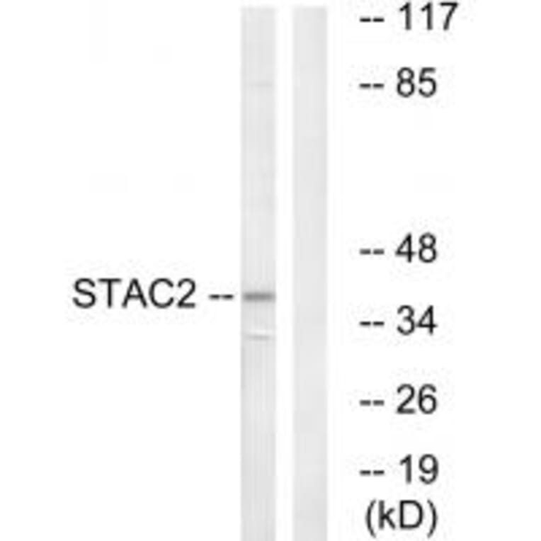 Western blot - STAC2 Antibody from Signalway Antibody (35043) - Antibodies.com
