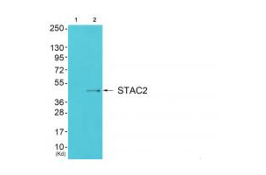 Western blot - STAC2 Antibody from Signalway Antibody (35043) - Antibodies.com