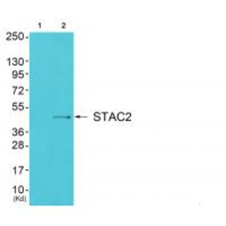 Western blot - STAC2 Antibody from Signalway Antibody (35043) - Antibodies.com
