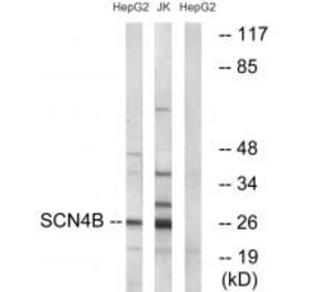 Western blot - SCN4B Antibody from Signalway Antibody (35053) - Antibodies.com