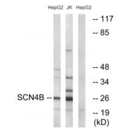 Western blot - SCN4B Antibody from Signalway Antibody (35053) - Antibodies.com