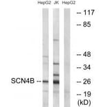 Western blot - SCN4B Antibody from Signalway Antibody (35053) - Antibodies.com
