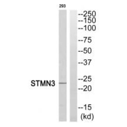 Western blot - STMN3 Antibody from Signalway Antibody (35078) - Antibodies.com