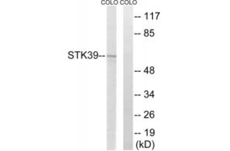 Western blot - STK39 Antibody from Signalway Antibody (35079) - Antibodies.com