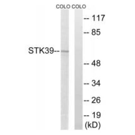 Western blot - STK39 Antibody from Signalway Antibody (35079) - Antibodies.com