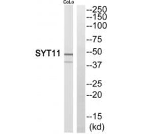 Western blot - SYT11 Antibody from Signalway Antibody (35082) - Antibodies.com