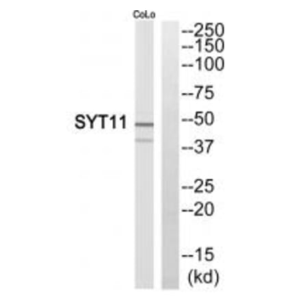 Western blot - SYT11 Antibody from Signalway Antibody (35082) - Antibodies.com