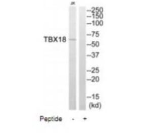 Western blot - TBX18 Antibody from Signalway Antibody (35087) - Antibodies.com