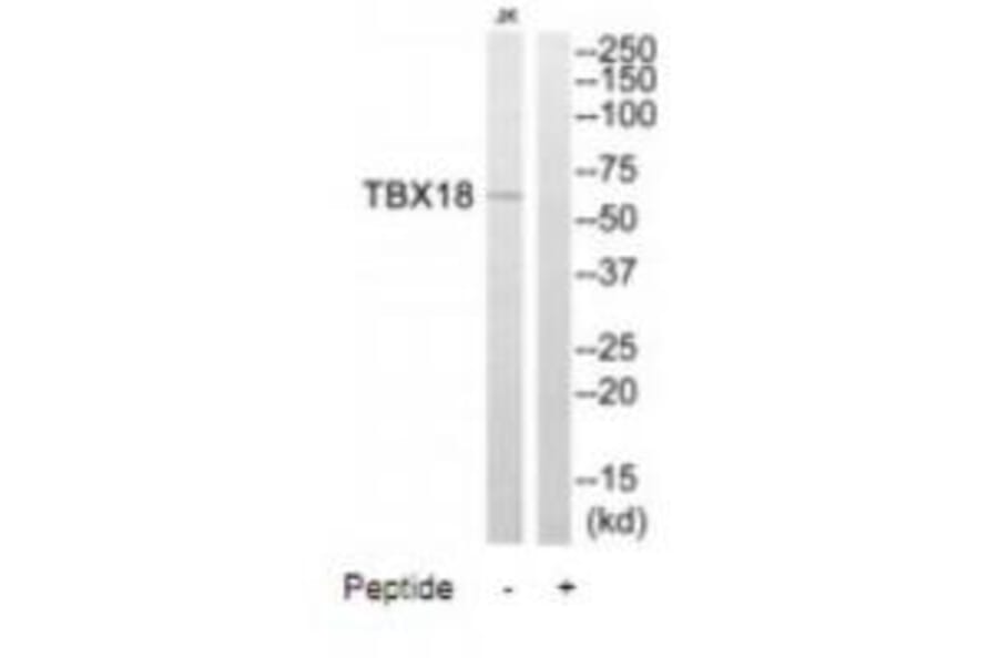 Western blot - TBX18 Antibody from Signalway Antibody (35087) - Antibodies.com