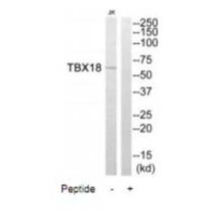 Western blot - TBX18 Antibody from Signalway Antibody (35087) - Antibodies.com