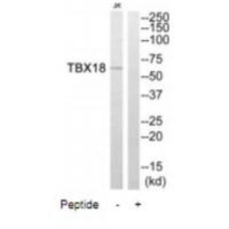 Western blot - TBX18 Antibody from Signalway Antibody (35087) - Antibodies.com